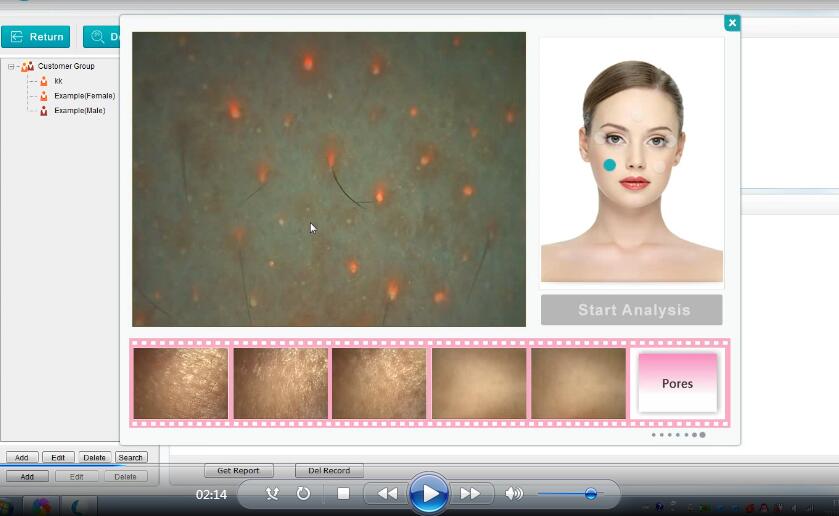 skin analyzer video.jpg