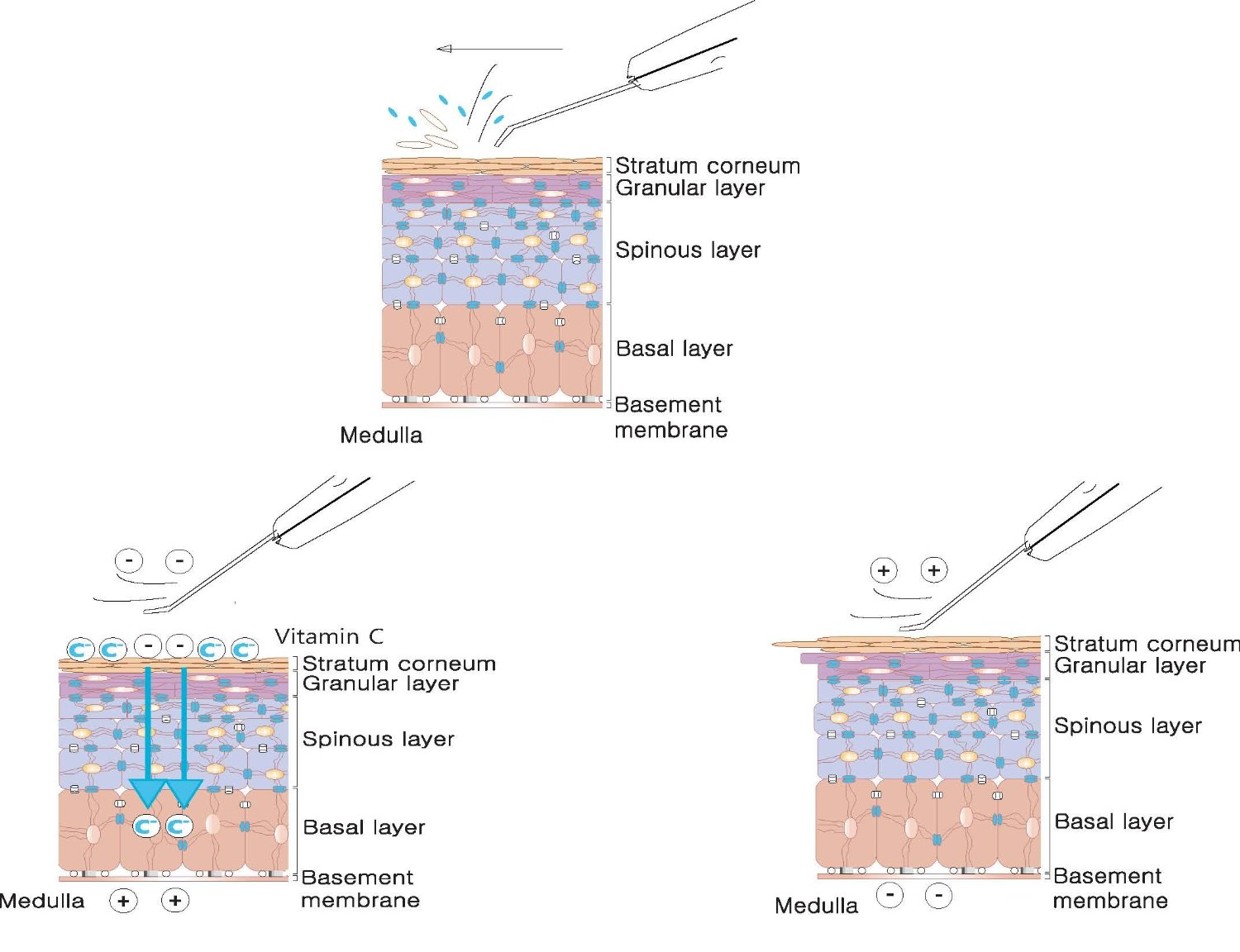 Ultrasonic Skin Scrubber Cell Cortex Mimic
