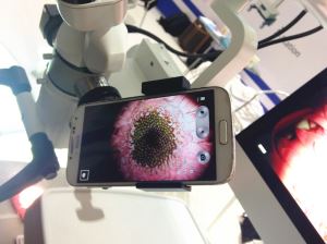 Universal Cellphone Adapter For Microscope