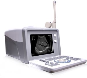 Handheld Doppler Ultrasound Scanner/portable Ultrasound Machines For Sale