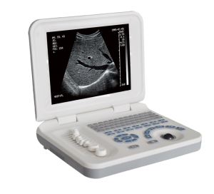 Best Price Ultrasound Scanner Machine With Wireless Ultrasound Probe/ultrasound Device