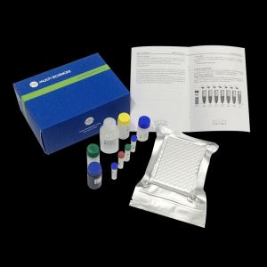 Rat IgM Antibody ELISA Kit