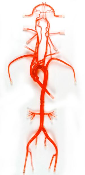 Carotid Artery Bypass Grafting Model